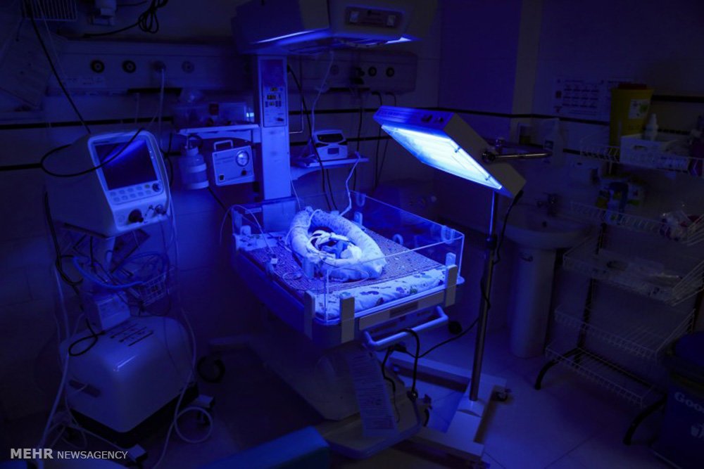 is jaundice transmittable